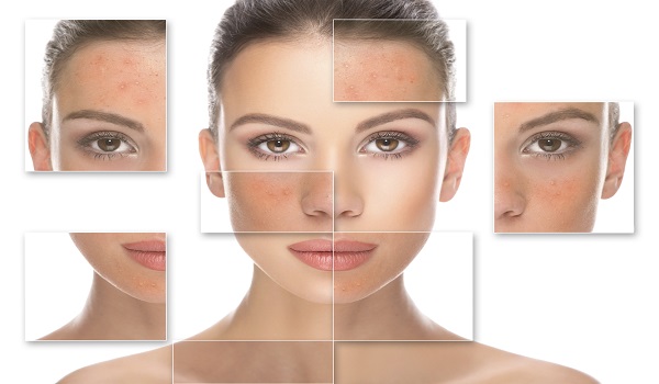 cosmetic dermatology treatment in Delhi