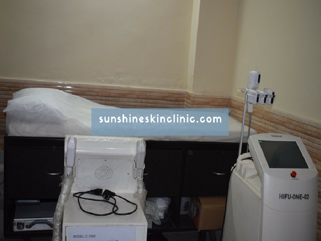sunshine-skin-clinic-delhi