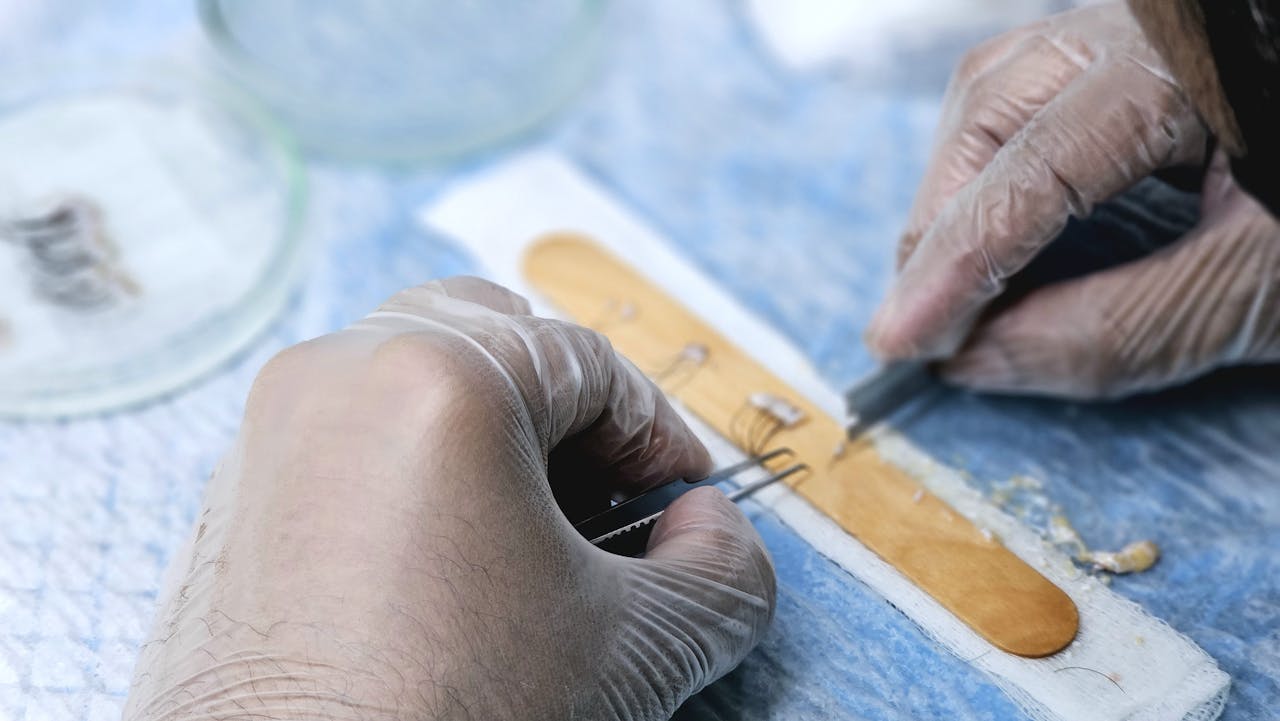 Close-up of surgeons preparing hair grafts for transplantation, demonstrating precise skills.